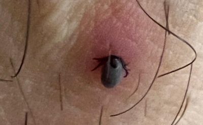 Más respuestas sobre la plaga de garrapatas en entornos urbanos