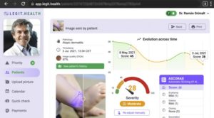 La inteligencia artificial resulta eficaz para la dermatitis atópica